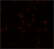 Anti-FREM2 antibody produced in rabbit affinity isolated antibody, buffered aqueous solution