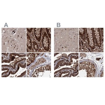 Anti-RPAP3 antibody produced in rabbit Prestige Antibodies® Powered by Atlas Antibodies, affinity isolated antibody, buffered aqueous glycerol solution