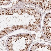Anti-POLD3 antibody produced in rabbit Prestige Antibodies® Powered by Atlas Antibodies, affinity isolated antibody, buffered aqueous glycerol solution