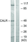 Anti-CALR antibody produced in rabbit affinity isolated antibody
