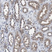 Anti-PDCD6IP antibody produced in rabbit Prestige Antibodies® Powered by Atlas Antibodies, affinity isolated antibody, buffered aqueous glycerol solution
