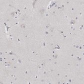 Anti-MATN1 antibody produced in rabbit Prestige Antibodies® Powered by Atlas Antibodies, affinity isolated antibody, buffered aqueous glycerol solution