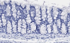 Anti-iNOS (NOSII) Antibody, clone 2G17 ZooMAb® Rabbit Monoclonal recombinant, expressed in HEK 293 cells