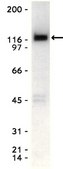 Anti-Eck/EphA2 Antibody, clone D7 clone D7, Upstate®, from mouse