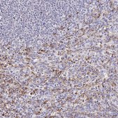 Anti-CYBB antibody produced in rabbit Prestige Antibodies® Powered by Atlas Antibodies, affinity isolated antibody, buffered aqueous glycerol solution