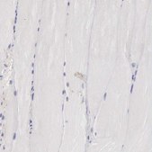 Anti-CLU antibody produced in rabbit Prestige Antibodies® Powered by Atlas Antibodies, affinity isolated antibody, buffered aqueous glycerol solution