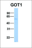 抗 GOT1 兔抗 IgG fraction of antiserum