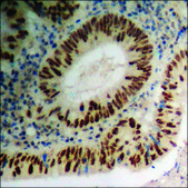 抗-磷酸-TIE2 (pTyr1108) 兔抗 affinity isolated antibody