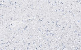 Anti-Aquaporin-4 Antibody, clone 1K2 ZooMAb® Rabbit Monoclonal recombinant, expressed in HEK 293 cells