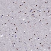 Anti-TBR1 Prestige Antibodies® Powered by Atlas Antibodies, affinity isolated antibody