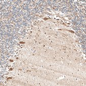 Anti-NTRK1 antibody produced in rabbit Prestige Antibodies® Powered by Atlas Antibodies, affinity isolated antibody, buffered aqueous glycerol solution