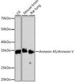 Anti-Annexin A5/Annexin V Antibody, clone 9A5M8, Rabbit Monoclonal