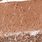 Monoclonal Anti-PTEN antibody produced in mouse Prestige Antibodies® Powered by Atlas Antibodies, clone CL11722, purified immunoglobulin, buffered aqueous glycerol solution