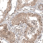 Monoclonal Anti-SMAD4 antibody produced in mouse Prestige Antibodies® Powered by Atlas Antibodies, clone CL9774, purified immunoglobulin, buffered aqueous glycerol solution