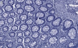 Anti-Caspase-8 Antibody, clone 1L15 ZooMAb® Rabbit Monoclonal recombinant, expressed in HEK 293 cells