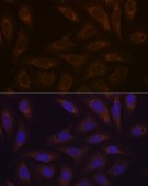 Anti-DCP1A antibody produced in rabbit