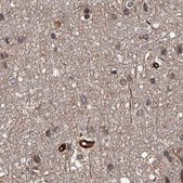 Anti-RPAP3 antibody produced in rabbit Prestige Antibodies® Powered by Atlas Antibodies, affinity isolated antibody, buffered aqueous glycerol solution