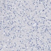 Anti-TAGLN antibody produced in rabbit affinity isolated antibody, buffered aqueous glycerol solution