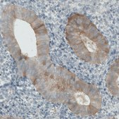 Monoclonal Anti-PHGDH antibody produced in mouse Prestige Antibodies® Powered by Atlas Antibodies, clone CL0555, purified immunoglobulin, buffered aqueous glycerol solution