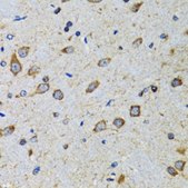 Anti-CDK1 antibody produced in rabbit