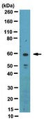 Anti-RARα Antibody, clone 9α-9A6 ascites fluid, clone 9α-9A6, from mouse