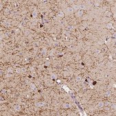 Anti-CNP antibody produced in rabbit Prestige Antibodies® Powered by Atlas Antibodies, affinity isolated antibody, buffered aqueous glycerol solution, Ab2