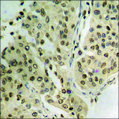 Anti-phospho-JAK2 (pTyr1007) antibody produced in rabbit affinity isolated antibody