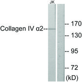 Anti-Collagen IV α2 antibody produced in rabbit affinity isolated antibody