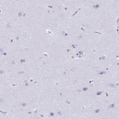 Anti-CDA antibody produced in rabbit Prestige Antibodies® Powered by Atlas Antibodies, affinity isolated antibody, buffered aqueous glycerol solution