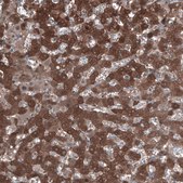 Anti-ALDH1A1 antibody produced in rabbit Prestige Antibodies® Powered by Atlas Antibodies, affinity isolated antibody, buffered aqueous glycerol solution