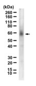 Anti-ST2/IL-33R Antibody, clone 1N22 ZooMAb® Rabbit Monoclonal recombinant, expressed in HEK 293 cells