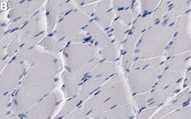 Anti-SLC16A3/MCT4 Antibody, clone 2J22 ZooMAb® Rabbit Monoclonal recombinant, expressed in HEK 293 cells