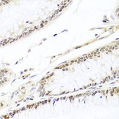 Anti- HIRA antibody produced in rabbit