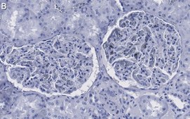 Anti-Podocin Antibody, clone 1C10 ZooMAb® Rabbit Monoclonal recombinant, expressed in HEK 293 cells