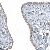 Anti-FGFR2 antibody produced in rabbit Prestige Antibodies® Powered by Atlas Antibodies, affinity isolated antibody, buffered aqueous glycerol solution