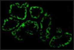 Anti-ACE2 antibody produced in rabbit affinity isolated antibody