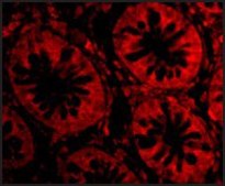 Anti-TEM1 (ab1) antibody produced in rabbit affinity isolated antibody, buffered aqueous solution