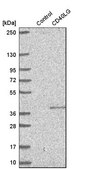 Anti-CD40LG antibody produced in rabbit Prestige Antibodies® Powered by Atlas Antibodies, affinity isolated antibody, buffered aqueous glycerol solution