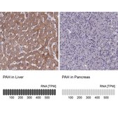 Anti-PAH antibody produced in rabbit Prestige Antibodies® Powered by Atlas Antibodies, affinity isolated antibody, buffered aqueous glycerol solution