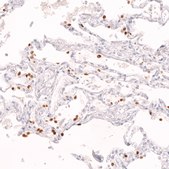Monoclonal Anti-Nkx2-1 Antibody Produced In Mouse Prestige Antibodies® Powered by Atlas Antibodies, clone CL14523, affinity isolated antibody, buffered aqueous glycerol solution