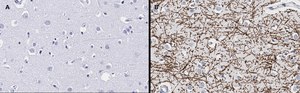 Anti-MBP Antibody, clone 2N6 , ZooMAb® Rabbit Monoclonal recombinant, expressed in HEK 293 cells