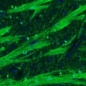 Monoclonal Anti-CNP antibody produced in mouse Prestige Antibodies® Powered by Atlas Antibodies, clone CL2872, purified immunoglobulin, buffered aqueous glycerol solution