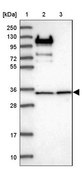 Anti-RPL5 antibody produced in rabbit Prestige Antibodies® Powered by Atlas Antibodies, affinity isolated antibody, buffered aqueous glycerol solution