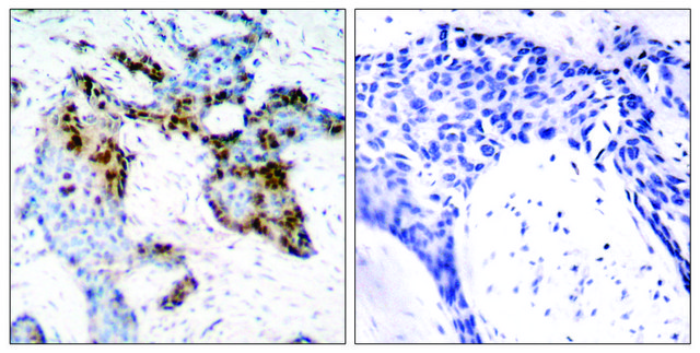 Anti-Estrogen Receptor-α antibody produced in rabbit affinity isolated antibody