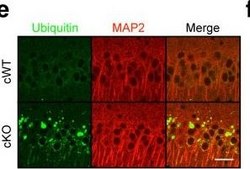 Anti-Microtubule-Associated Protein 2 (MAP2) Antibody Chemicon®, from rabbit