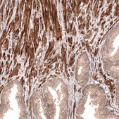 Anti-CACNA1H antibody produced in rabbit Prestige Antibodies® Powered by Atlas Antibodies, affinity isolated antibody, buffered aqueous glycerol solution