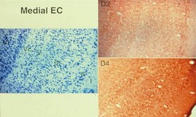 抗-多巴胺D2受体抗体 Chemicon®, from rabbit
