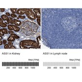Anti-ASS1 antibody produced in rabbit Prestige Antibodies® Powered by Atlas Antibodies, affinity isolated antibody, buffered aqueous glycerol solution, Ab1