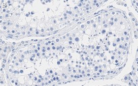 Anti-RAD51 Antibody, clone 1M8 ZooMAb® Rabbit Monoclonal recombinant, expressed in HEK 293 cells