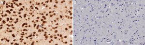 Anti-NeuN Antibody (rabbit) from rabbit, purified by affinity chromatography